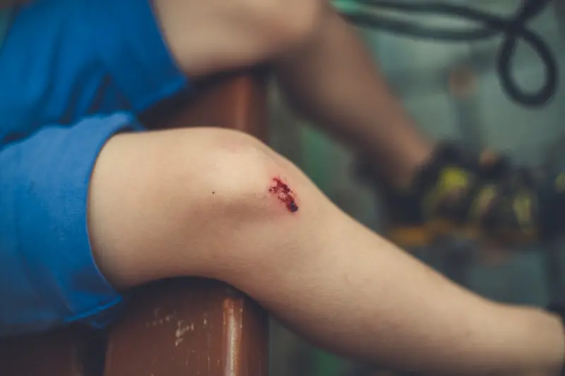 When Hidden Injuries Surface: A Personal Injury Lawyer’s Guide to Pre‑Existing Conditions When Hidden Injuries Surface: A Personal Injury Lawyer’s Guide to Pre‑Existing Conditions